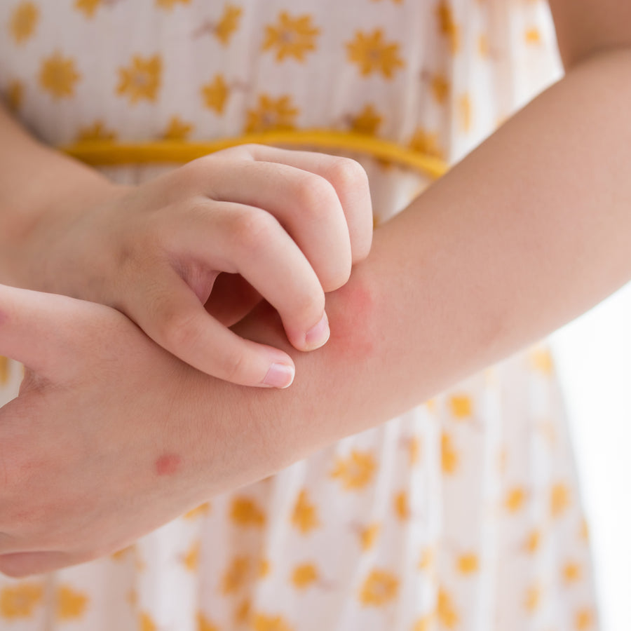 Itch-eze Pain Relief Soothing Lotion for stings and bites Fast-Acting Relief When You Need It Most Volume 100mls